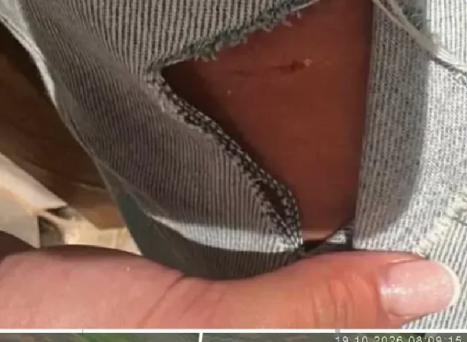(FOTO) Fetiță de 13 ani atacată de câini, în drum spre școală, în centrul Bacăului. A ajuns de urgență la spital